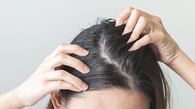Unilever Anti-Dandruff Range Responds To ‘Explosive’ Category Growth In China